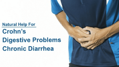 Crohn’s Disease